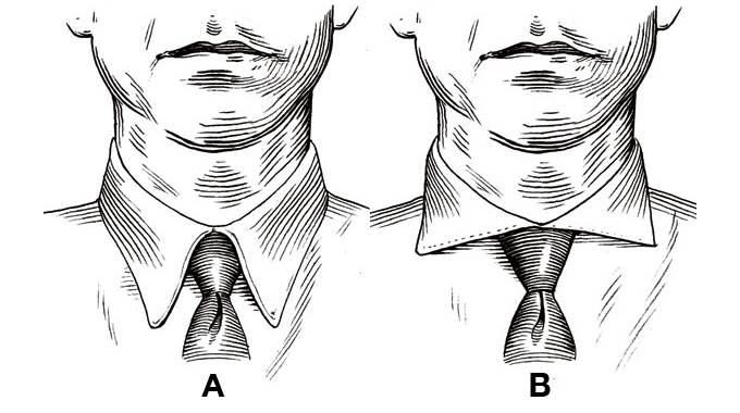 Ask the MB: MB Tie Compatibility Issue